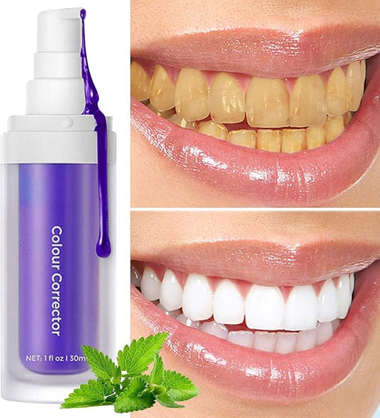 Blanqueador Dental SMILE V34