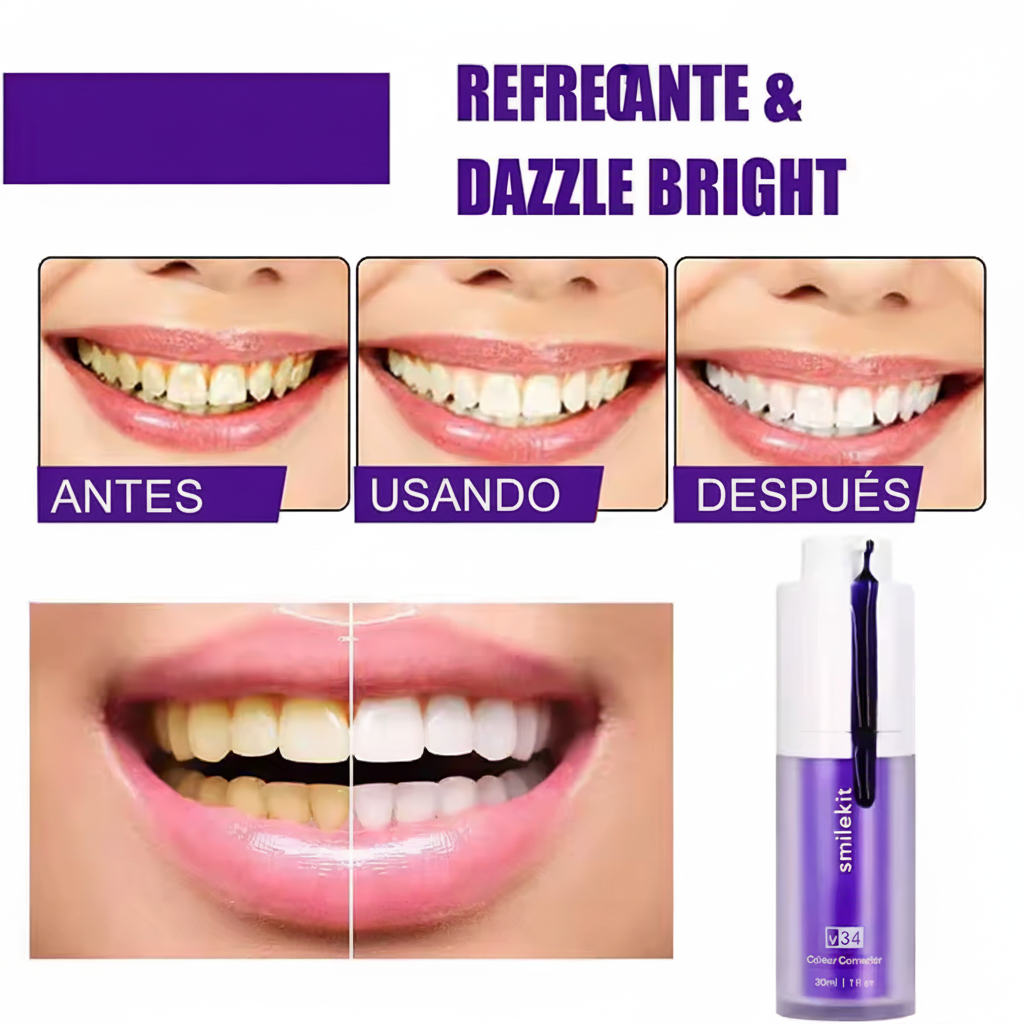 Blanqueador Dental SMILE V34