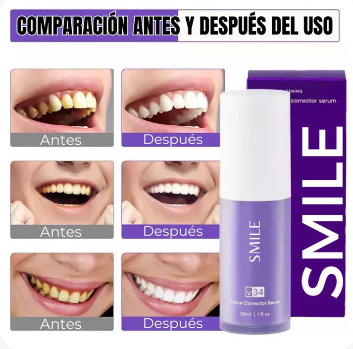 Blanqueador Dental SMILE V34